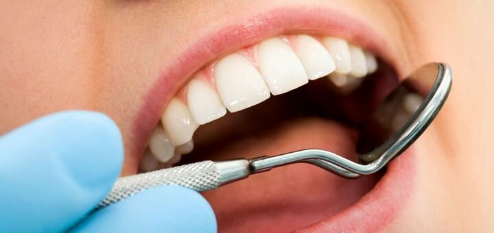 Вирівнювання зубів у «dental beauty clinic» в харкові. записатися акцією.