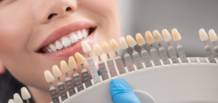 Promotions chain of dental clinics «Giorno Dentale»