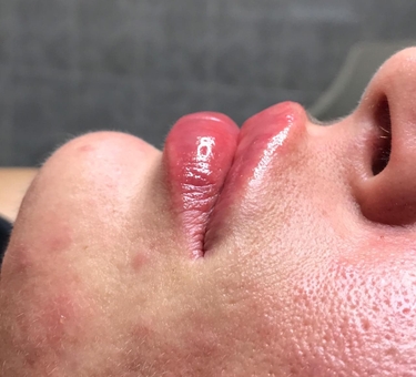 Косметологічний кабінет Олени Кузьменко в Києві. контурна пластика недорого.